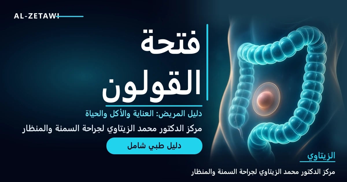 رسم طبي ثلاثي الأبعاد لبطن شفاف تتوهج فيه الأمعاء الغليظة بلون فيروزي مع فتحة دائرية صغيرة مرتبة على جدار البطن وحدود كيس دائري ناعم — فتحة القولون دليل المريض | د. محمد عبد الوهاب الزيتاوي