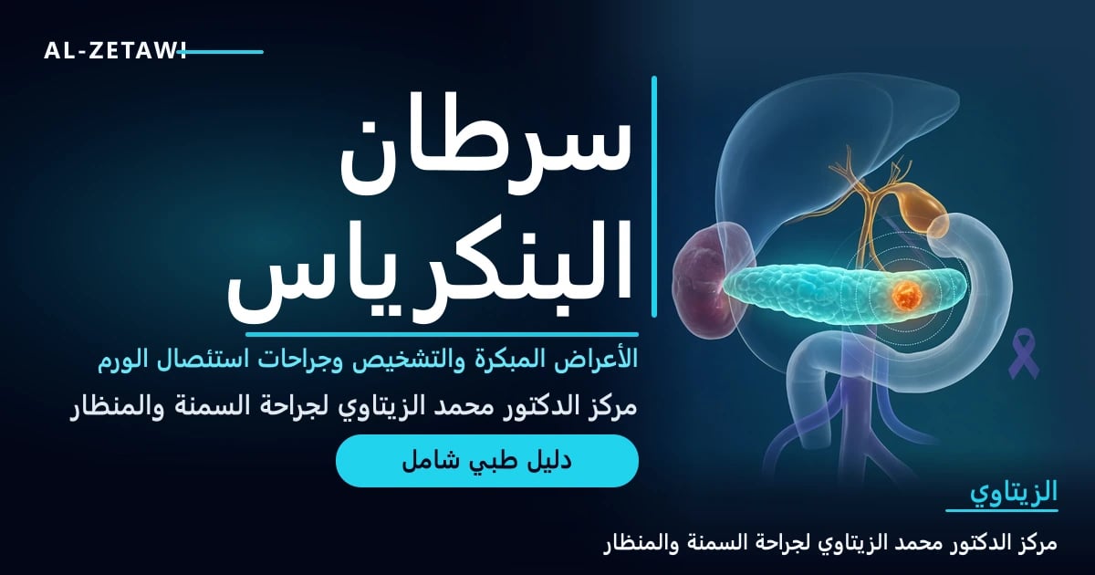 سرطان البنكرياس: الأعراض والأسباب والتشخيص والعلاج وجراحات استئصال الورم — صورة مقال طبي | د. محمد عبد الوهاب الزيتاوي