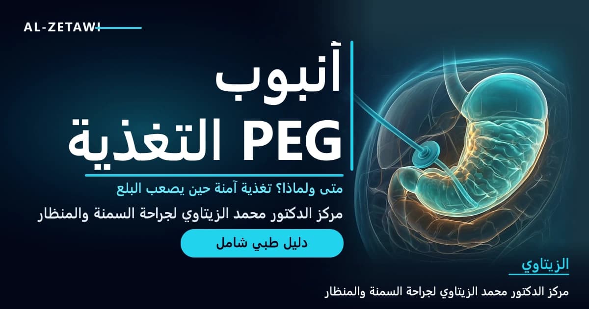 أنبوب التغذية PEG: متى ولماذا؟ | د. محمد عبد الوهاب الزيتاوي رسم طبي ثلاثي الأبعاد لمعدة شفافة بلون فيروزي مع أنبوب تغذية رفيع مرن يمر عبر جدار البطن إليها وقرص صغير مستدير عند الجلد — أنبوب التغذية PEG | د. محمد عبد الوهاب الزيتاوي