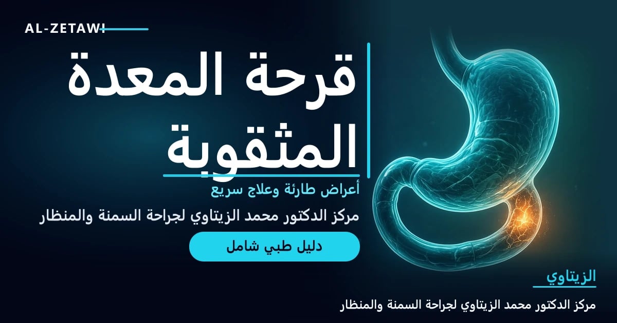 رسم طبي ثلاثي الأبعاد لمعدة واثني عشر شفافين بلون فيروزي مع نقطة ثقب صغيرة متوهجة بلون كهرماني على جدار الاثني عشر وضوء خافت يتسرب منها — قرحة المعدة المثقوبة | د. محمد عبد الوهاب الزيتاوي