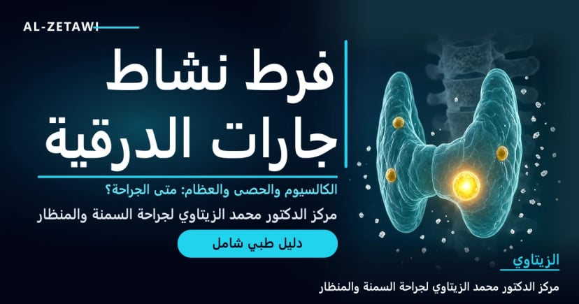 رسم طبي ثلاثي الأبعاد لغدة درقية شفافة من الخلف تظهر خلفها أربع غدد جارات درقية ذهبية صغيرة إحداها متضخمة ومضيئة مع بلورات كالسيوم وظل عظمة — فرط نشاط الغدد جارات الدرقية | د. محمد عبد الوهاب الزيتاوي