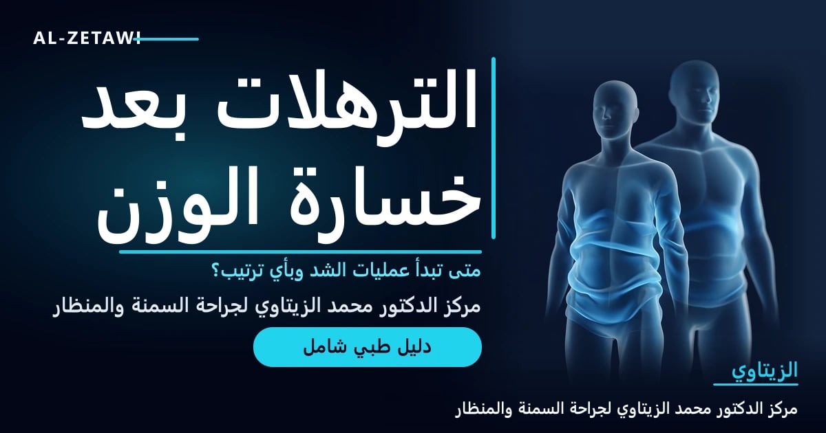 رسم طبي ثلاثي الأبعاد لجسمين شفافين يمثلان الجسم قبل خسارة الوزن وبعدها مع طيات جلد مترهل — الترهلات بعد خسارة الوزن | د. محمد عبد الوهاب الزيتاوي
