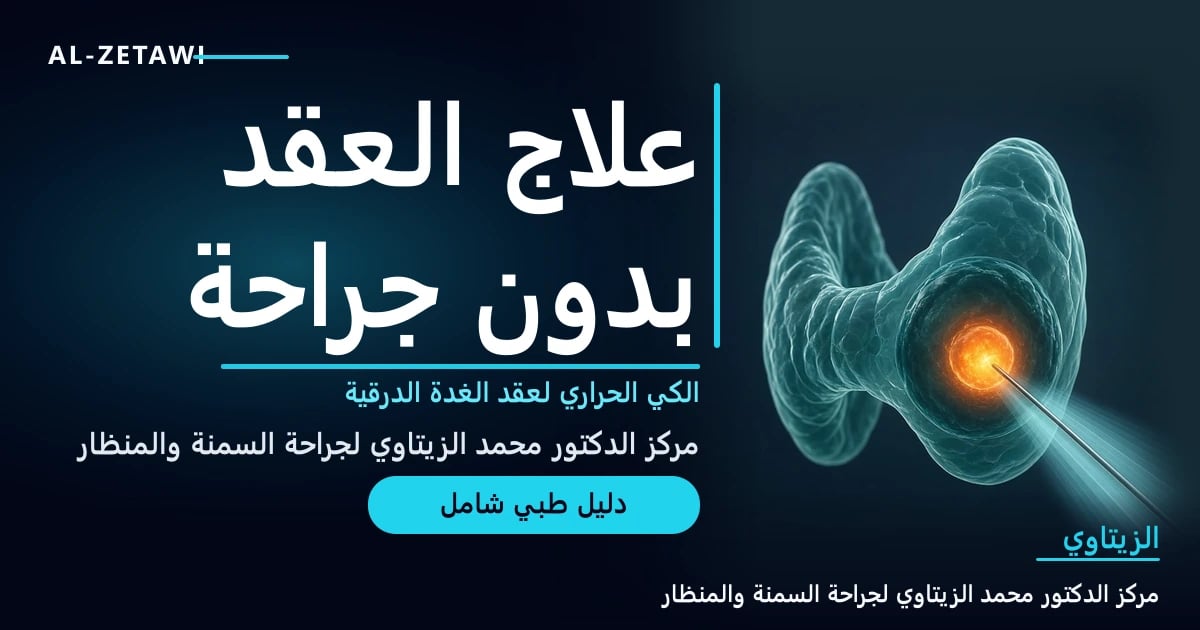 رسم طبي ثلاثي الأبعاد لعقدة في الغدة الدرقية تخترقها إبرة قطب رفيعة تشع وهجًا حراريًا برتقاليًا دافئًا بتوجيه شعاع الأشعة الصوتية — علاج عقيدات الغدة الدرقية بدون جراحة | د. محمد عبد الوهاب الزيتاوي