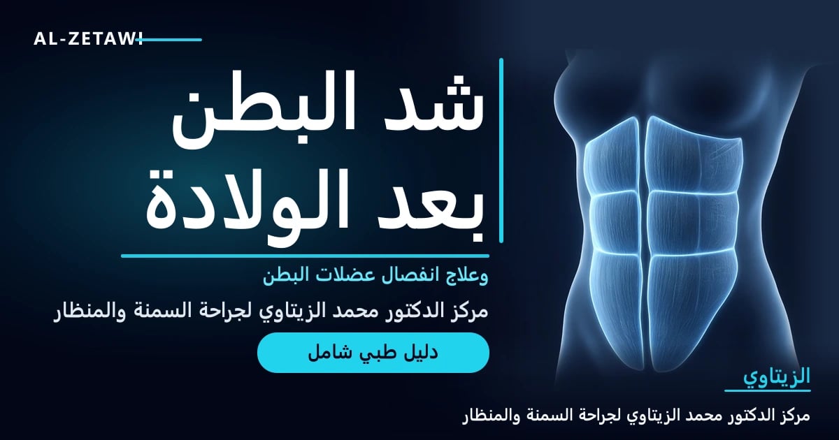 رسم طبي ثلاثي الأبعاد لعضلات البطن المستقيمة مع تباعد في المنتصف يمثل انفصال عضلات البطن بعد الحمل — شد البطن بعد الولادة | د. محمد عبد الوهاب الزيتاوي