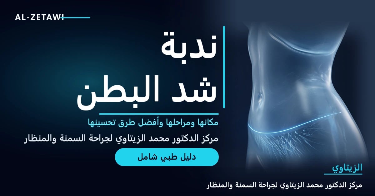 رسم طبي ثلاثي الأبعاد لبطن امرأة مع خط مضيء رفيع منخفض يمثل ندبة شد البطن — ندبة شد البطن | د. محمد عبد الوهاب الزيتاوي
