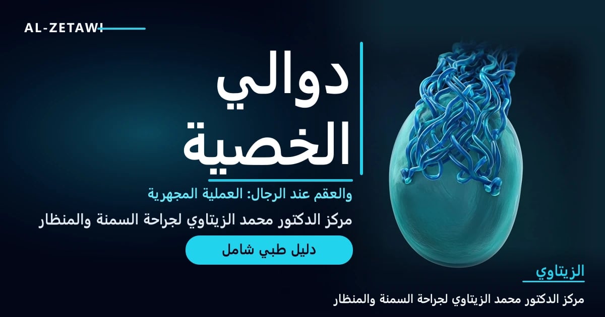 رسم طبي ثلاثي الأبعاد تخطيطي لخصية تحيط بها شبكة من الأوردة الزرقاء المتوسعة والملتوية بأسلوب سريري غير صريح — دوالي الخصية والعقم | د. محمد عبد الوهاب الزيتاوي