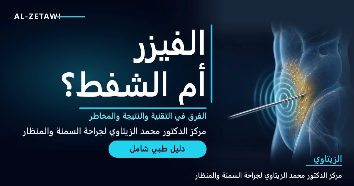 رسم طبي ثلاثي الأبعاد لجذع شفاف مع مسبار رفيع يطلق موجات فوق صوتية تفكك الدهون تحت الجلد — الفيزر أم الشفط التقليدي | د. محمد عبد الوهاب الزيتاوي