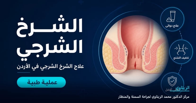 عملية الشق الشرجي — علاج الشرخ الشرجي في الأردن | د. محمد عبد الوهاب الزيتاوي