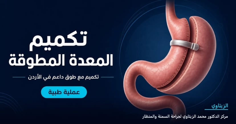 تكميم المعدة المطوقة — رسم توضيحي للعملية في الأردن | د. محمد عبد الوهاب الزيتاوي