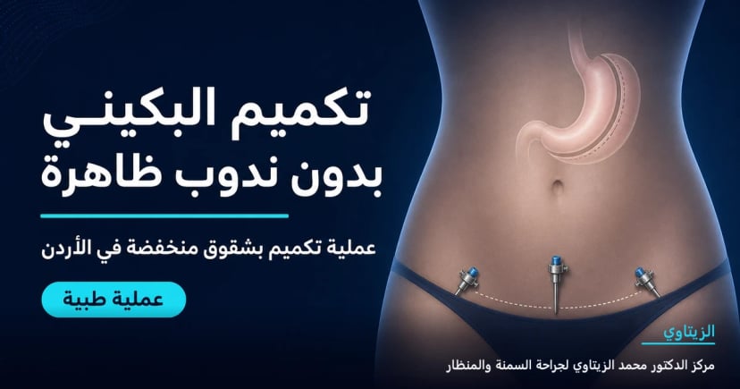تكميم البكيني بدون ندوب ظاهرة — رسم توضيحي للعملية في الأردن | د. محمد عبد الوهاب الزيتاوي