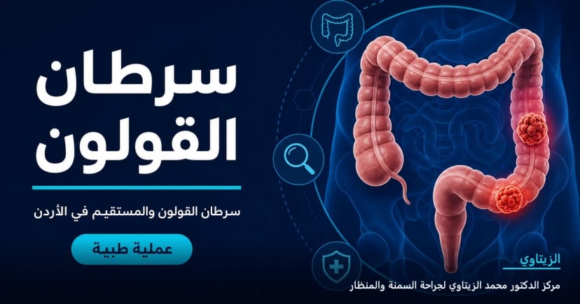 سرطان القولون والمستقيم — رسم توضيحي للعملية في الأردن | د. محمد عبد الوهاب الزيتاوي