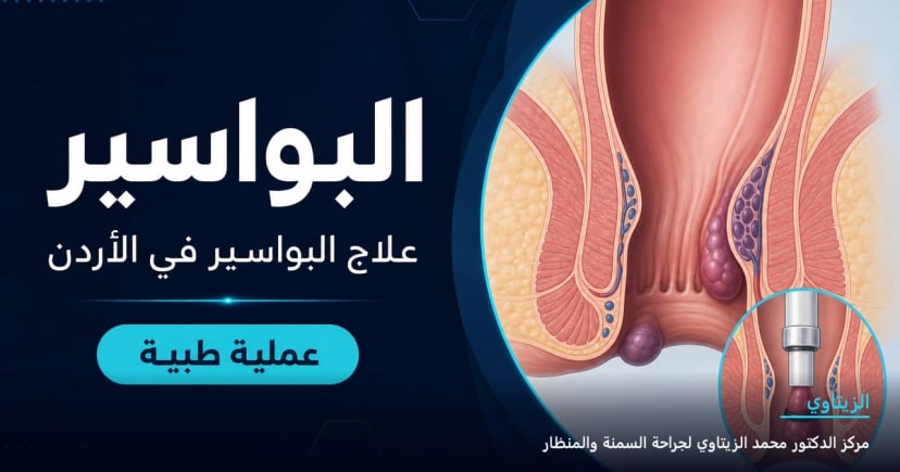 البواسير — رسم توضيحي للعملية في الأردن | د. محمد عبد الوهاب الزيتاوي