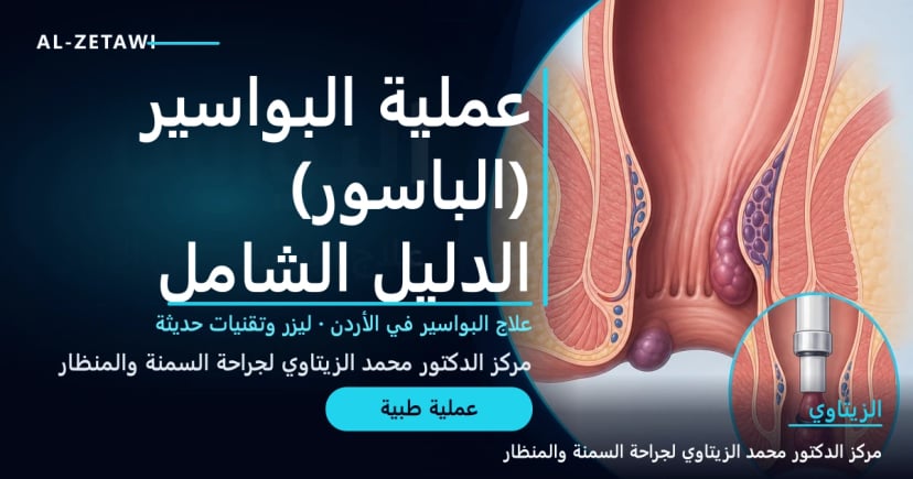 عملية البواسير (الباسور): الدليل الشامل — رسم توضيحي Ultra Premium لعلاج البواسير والباسور في الأردن | د. محمد عبد الوهاب الزيتاوي