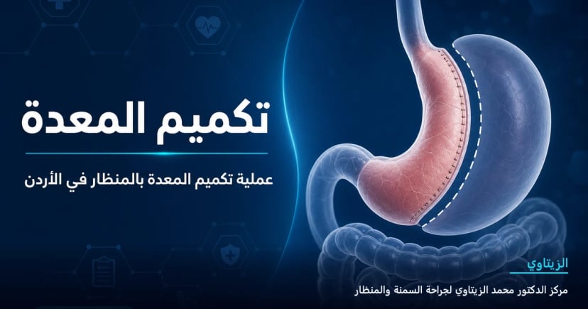 تكميم المعدة — رسم توضيحي للعملية في الأردن | د. محمد عبد الوهاب الزيتاوي