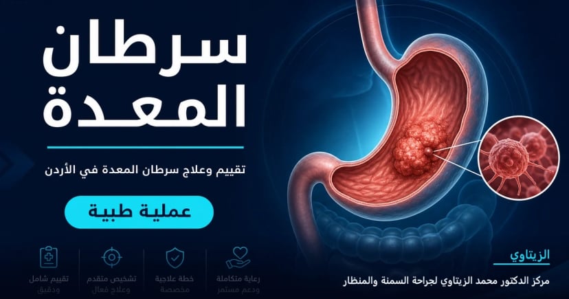 سرطان المعدة — رسم توضيحي للعملية في الأردن | د. محمد عبد الوهاب الزيتاوي