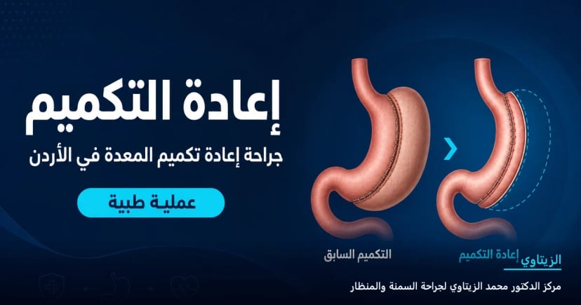 إعادة التكميم — رسم توضيحي للعملية في الأردن | د. محمد عبد الوهاب الزيتاوي