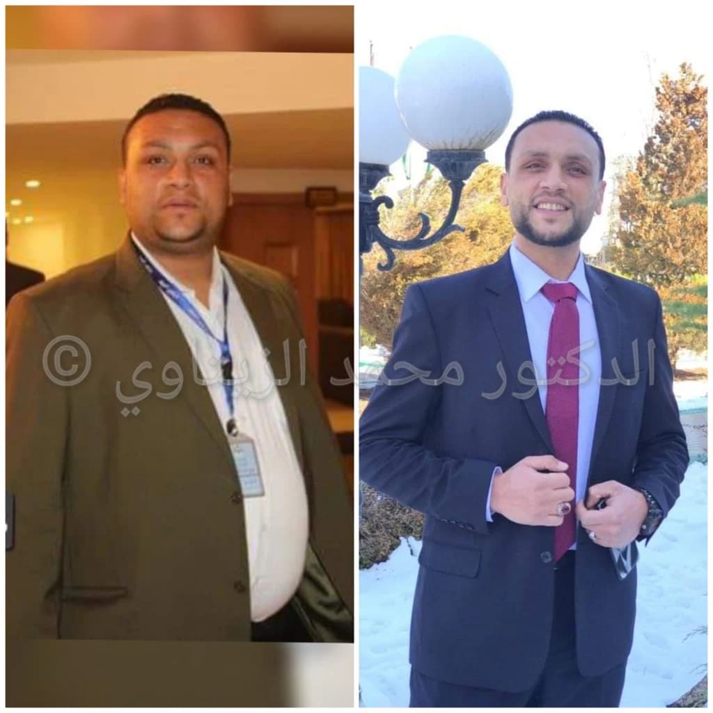Murad Al-Sayed before and after sleeve gastrectomy, second photo: 88 kg lighter | Dr. Al-Zaitawi Second before and after photo of Murad Al-Sayed in a suit: 88 kg lost after sleeve gastrectomy with Dr. Mohammad Al-Zaitawi
