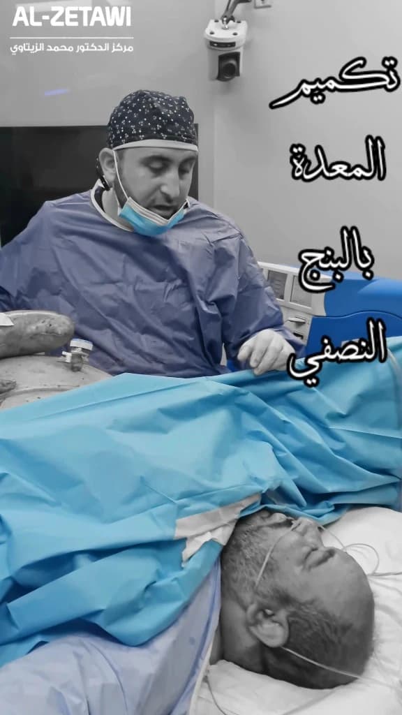 تكميم المعدة بالبنج النصفي مع د. محمد عبد الوهاب الزيتاوي د. محمد عبد الوهاب الزيتاوي بجانب مريض على طاولة العمليات أثناء تكميم المعدة بالبنج النصفي — مركز الدكتور محمد عبد الوهاب الزيتاوي