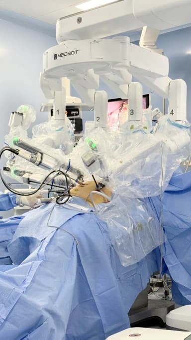 أذرع روبوت MedBot المرقّمة مثبّتة فوق المريض مع شاشة تعرض العملية أثناء أول عملية تكميم معدة بالروبوت في الأردن مع الدكتور محمد عبد الوهاب الزيتاوي