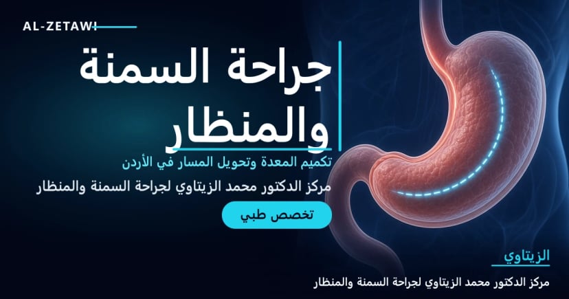 جراحة السمنة والمنظار رسم طبي ثلاثي الأبعاد للمعدة يوضح خط تكميم المعدة بالمنظار – تخصص جراحة السمنة والمنظار في مركز الدكتور محمد عبد الوهاب الزيتاوي في عمّان
