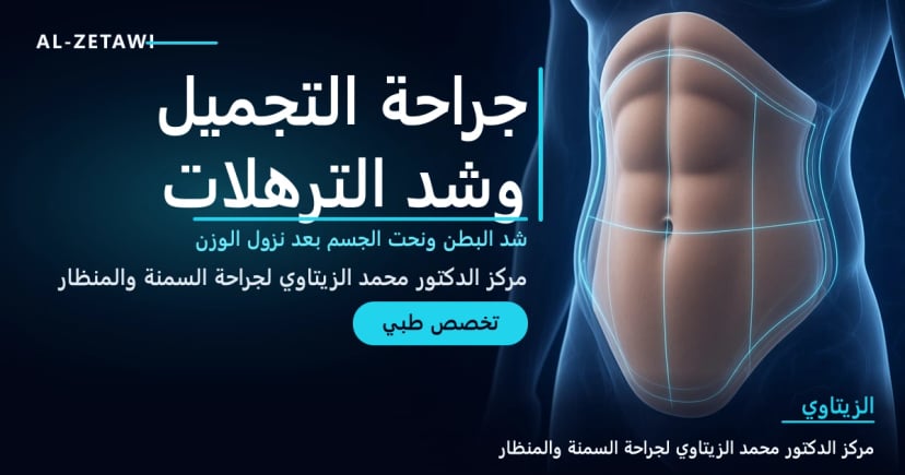 جراحة التجميل وشد الترهلات رسم طبي ثلاثي الأبعاد لمنطقة البطن مع خطوط تحديد القوام بعد شد البطن – تخصص جراحة التجميل وشد الترهلات بعد نزول الوزن في عمّان