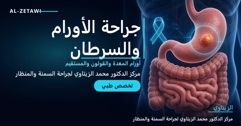 جراحة الأورام رسم طبي ثلاثي الأبعاد للمعدة والقولون مع تحديد ورم وشريط التوعية بالسرطان – تخصص جراحة الأورام في مركز الدكتور محمد عبد الوهاب الزيتاوي