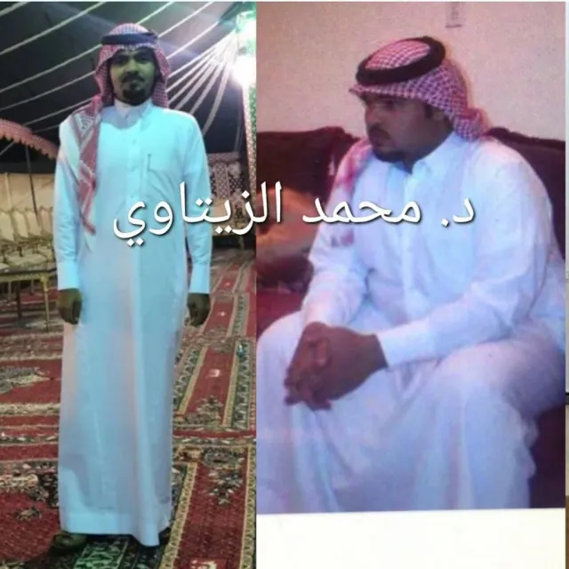 Before and after sleeve gastrectomy: Saud Al-Khalidi from Saudi Arabia went from 125 kg to 69 kg