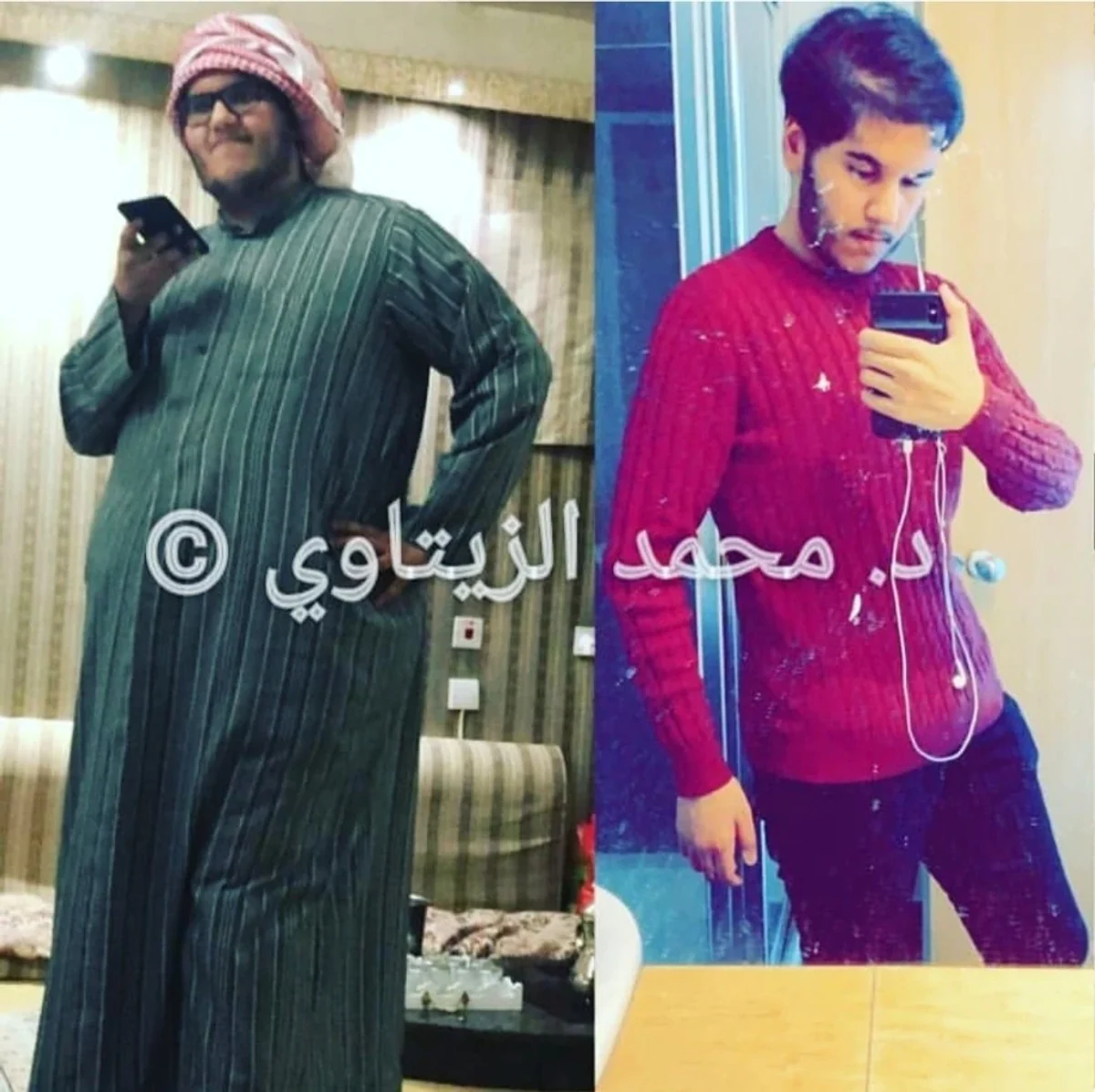 Sleeve gastrectomy result: 162 kg to 85 kg | Dr. Mohammad Al-Zaitawi Before and after sleeve gastrectomy: Mohammed from Qatar went from 162 kg to 85 kg – Dr. Mohammad Al-Zaitawi Center, Jordan