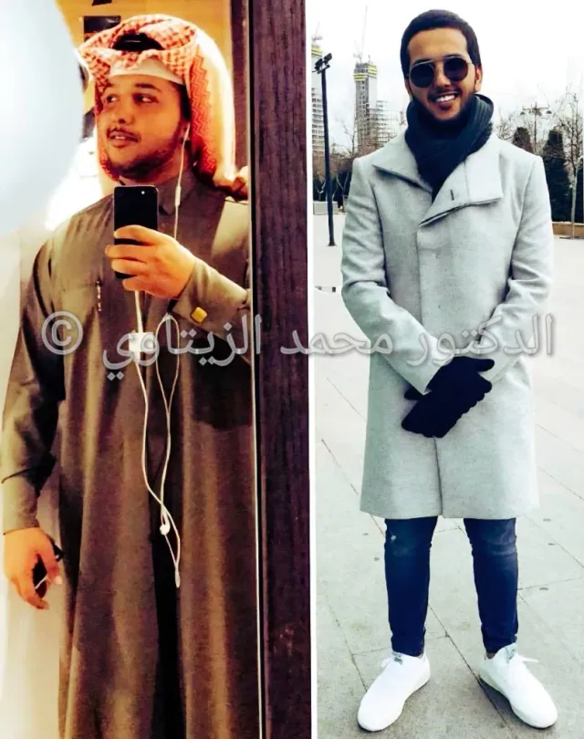 Before and after sleeve gastrectomy: Saleh Al-Shuaili from Qatar went from 110 kg to 68 kg