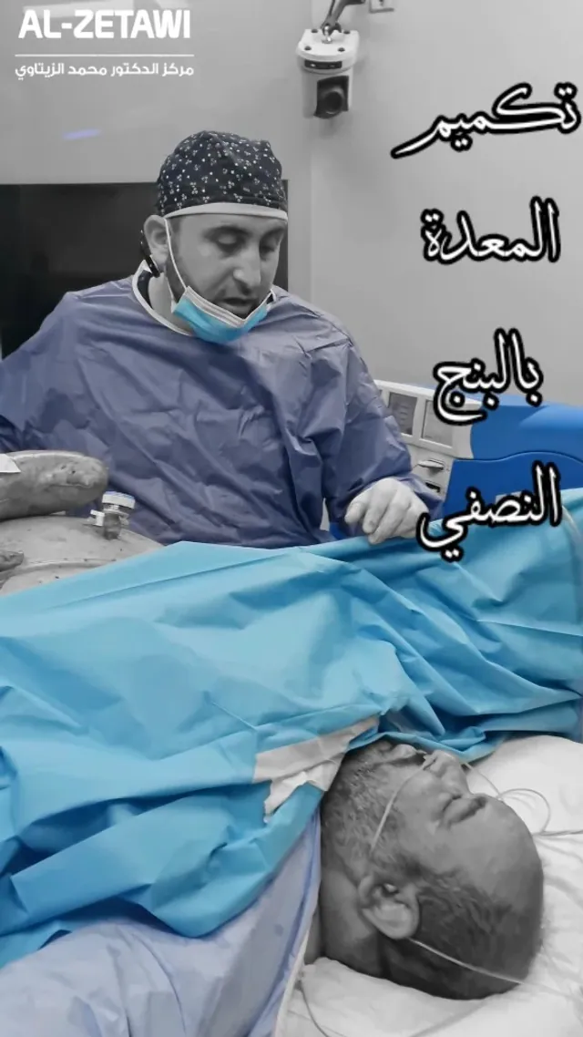 Sleeve gastrectomy under spinal anesthesia with Dr. Mohammad Al-Zaitawi Dr. Mohammad Al-Zaitawi beside a patient on the operating table during sleeve gastrectomy under spinal anesthesia