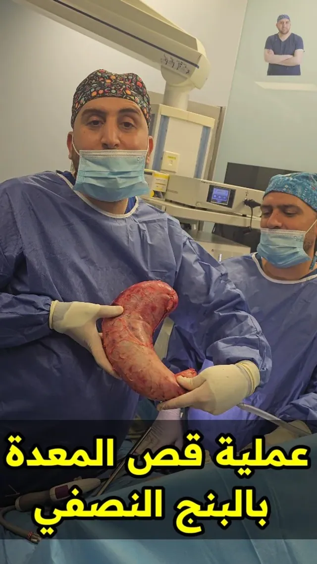 Dr. Mohammad Al-Zaitawi holding the removed part of the stomach after stomach reduction surgery under spinal anesthesia