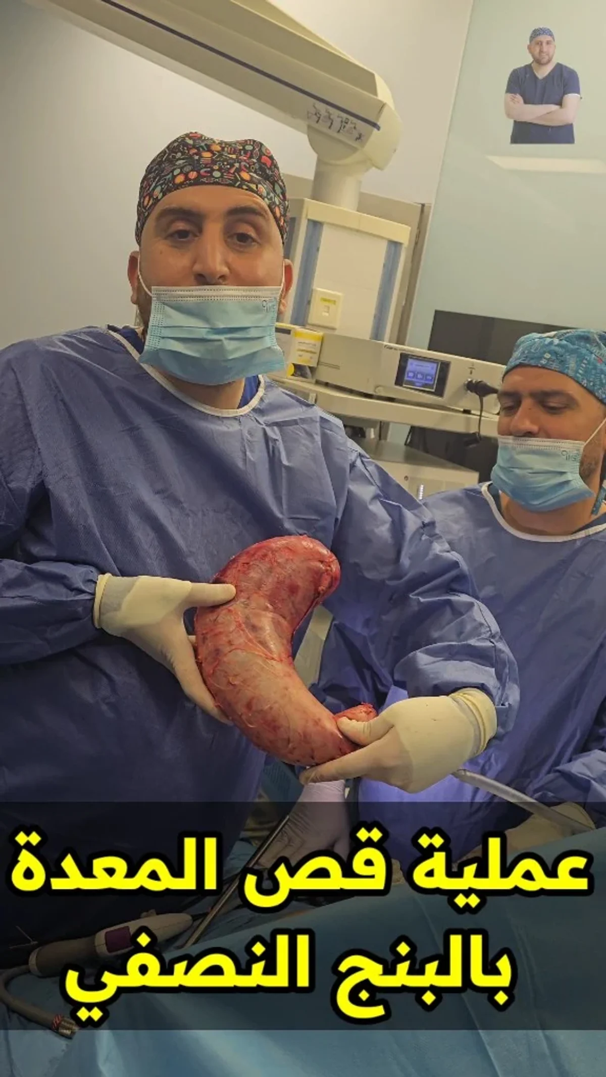Stomach reduction under spinal anesthesia: the removed stomach | Dr. Mohammad Al-Zaitawi Dr. Mohammad Al-Zaitawi holding the removed part of the stomach after stomach reduction surgery under spinal anesthesia