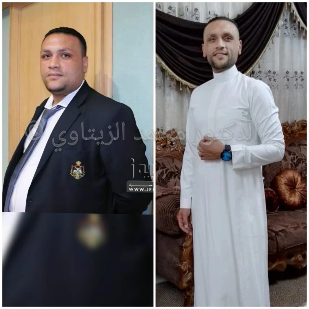 صورة قبل وبعد تكميم المعدة لمراد السيد من الأردن: من 178 كيلو إلى 90 كيلو، وما زال وزنه ثابتاً بعد 8 سنوات من العملية — مركز الدكتور محمد عبد الوهاب الزيتاوي